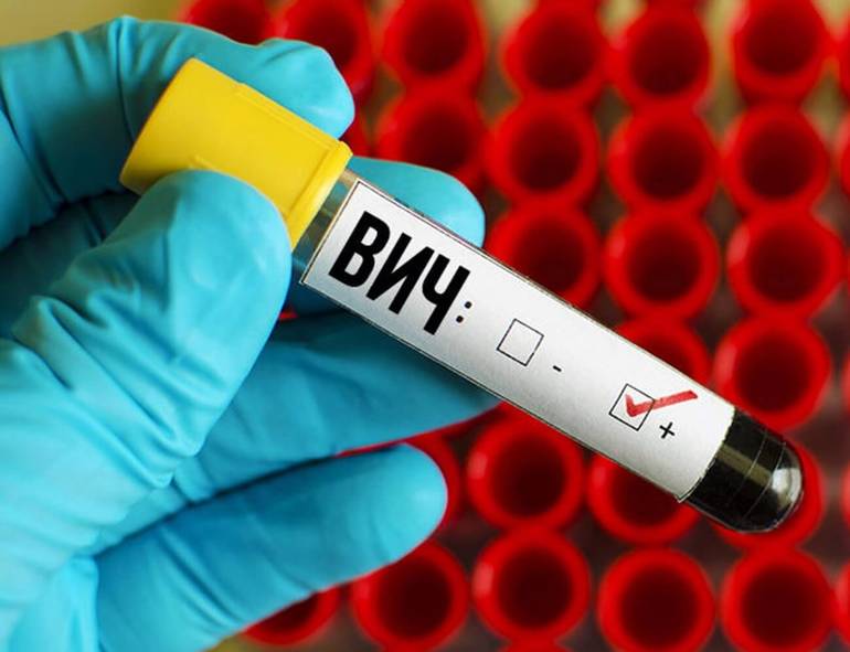 Причина, по которой ВИЧ-инфекция не лечится